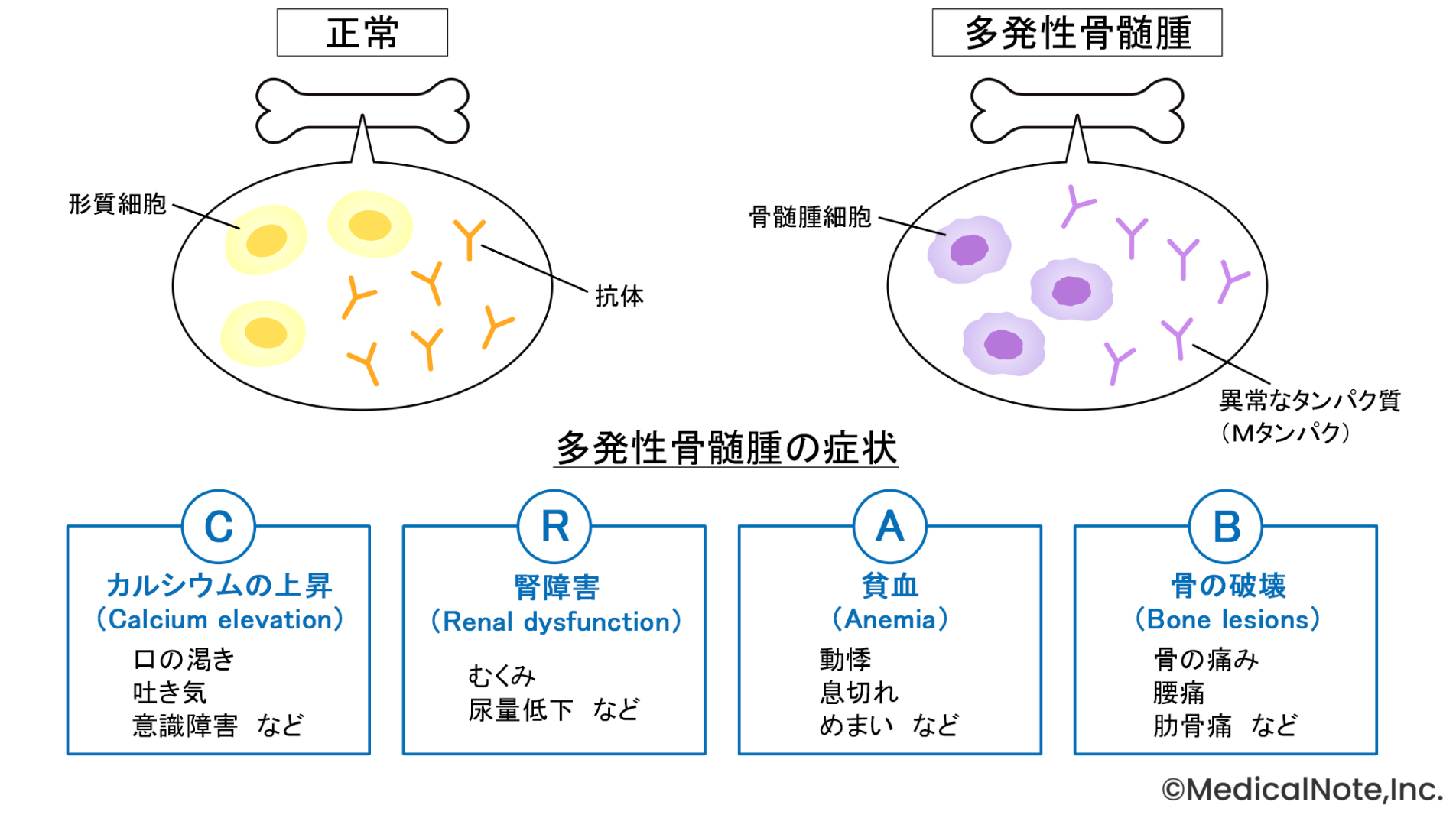 症状があっても必ずしも手遅れではない――治療は“CRAB症状が現れてから”