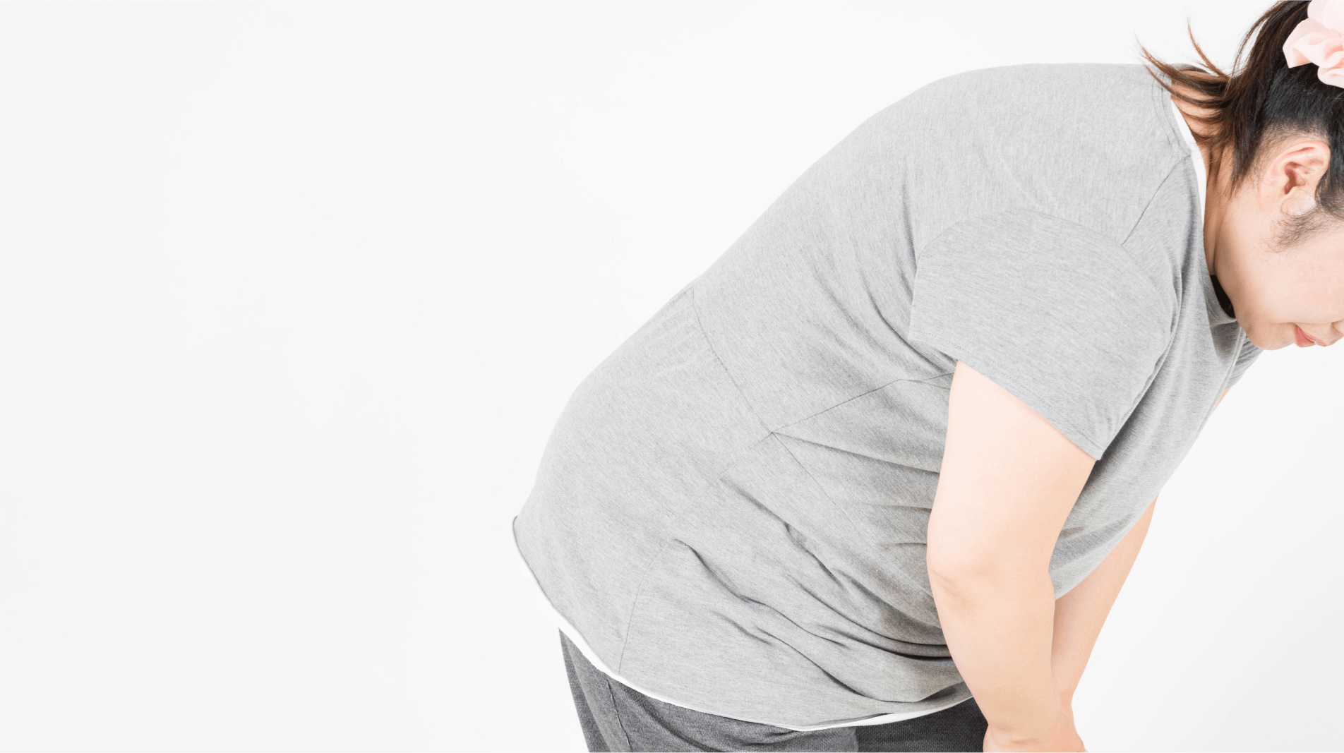 肥満症とは――BMIが25以上、かつ肥満が健康に影響している状態