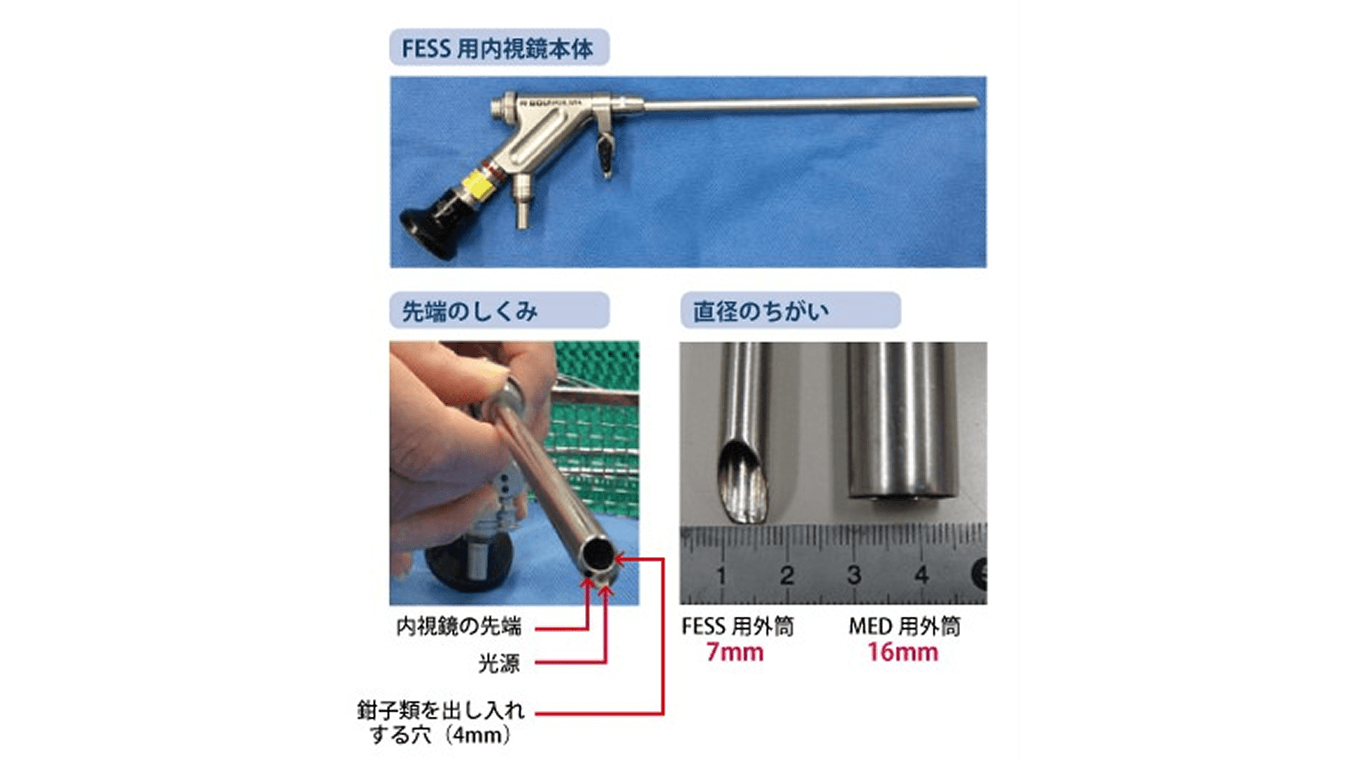約7mmの内視鏡を使用し、痛みの原因をピンポイントで取り除く手術
