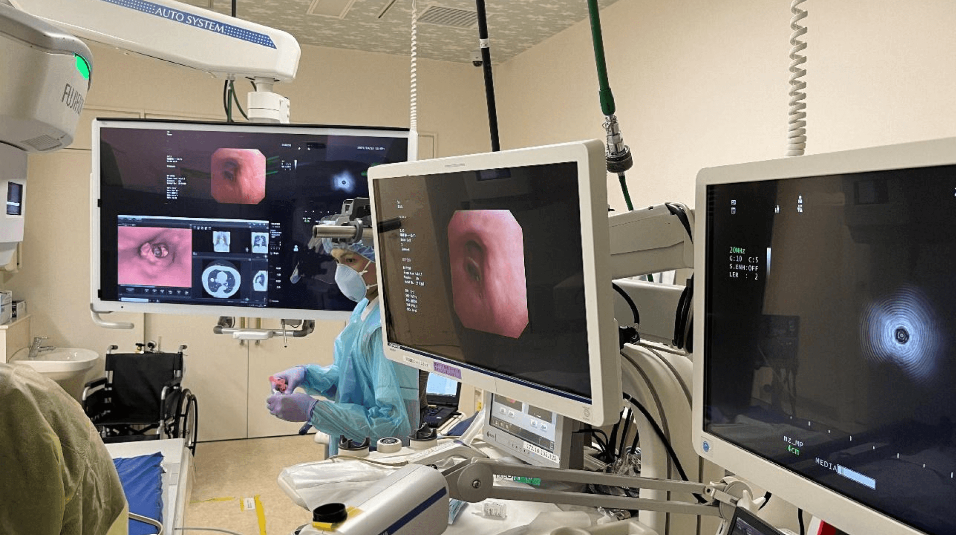 診断の正確性と患者さんの負担、どちらも考慮した気管支鏡検査