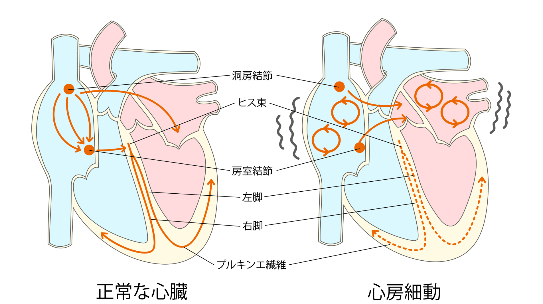 徐々に進行する病気――脈の乱れを感じたら放置せず受診を