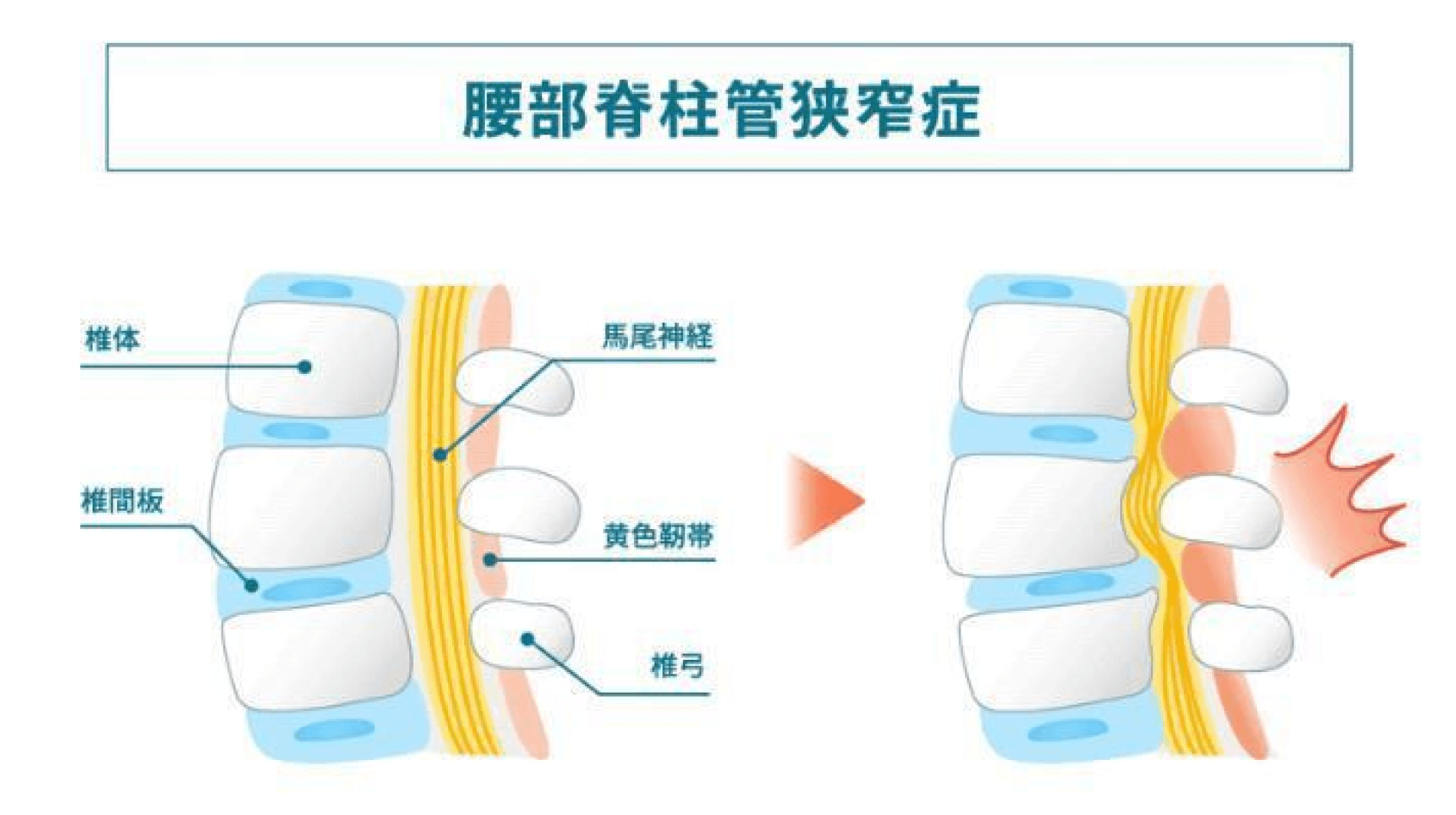 より多くの命を救うべく、診断精度の向上に取り組む