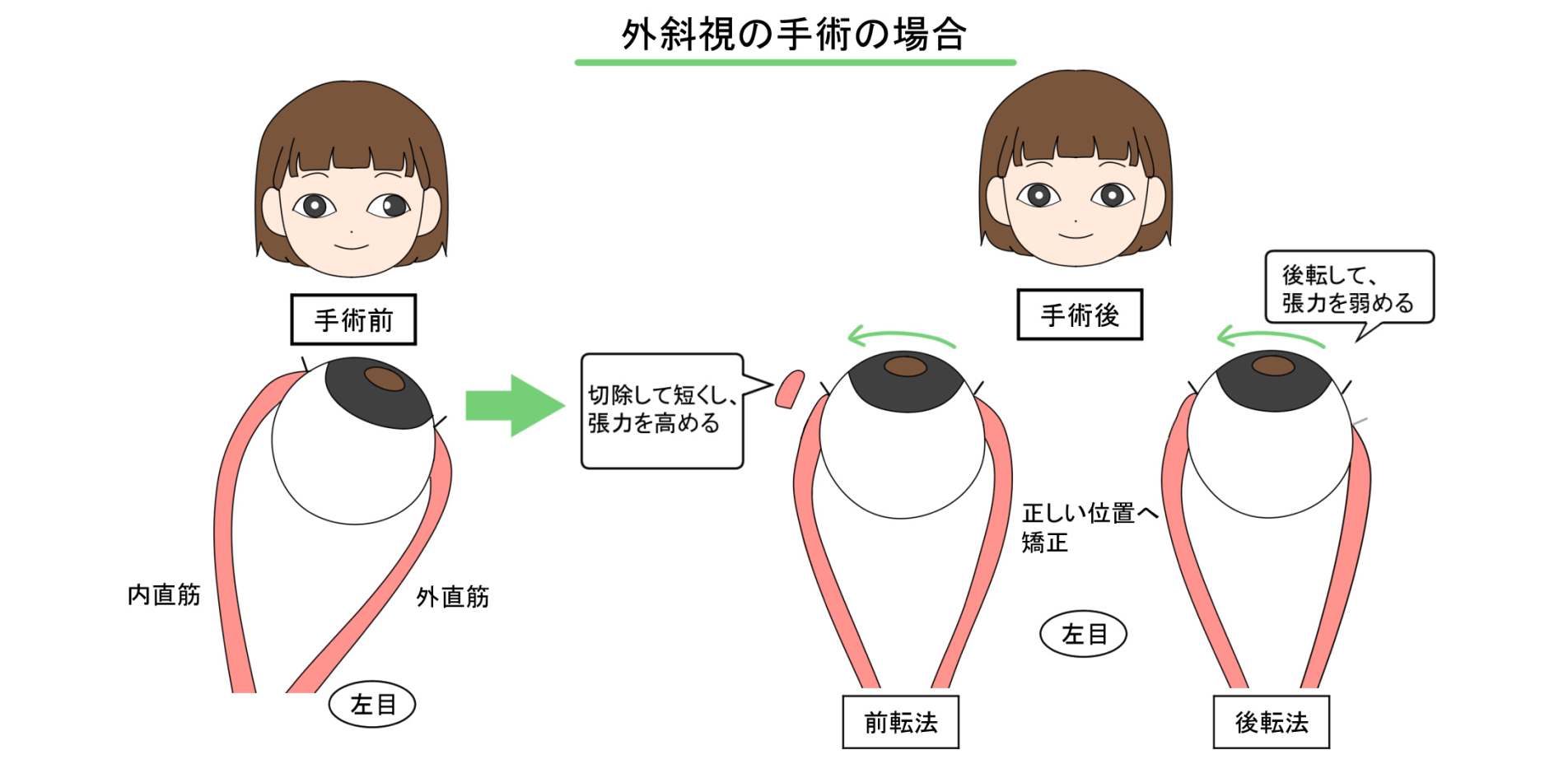 適切な手術時期を見逃さず治療を行う