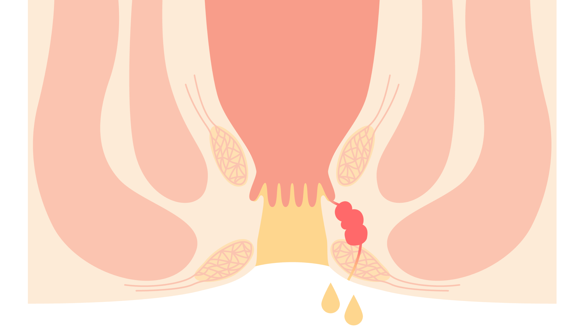 慢性化する前の治療が大切――放置せず早めに受診を