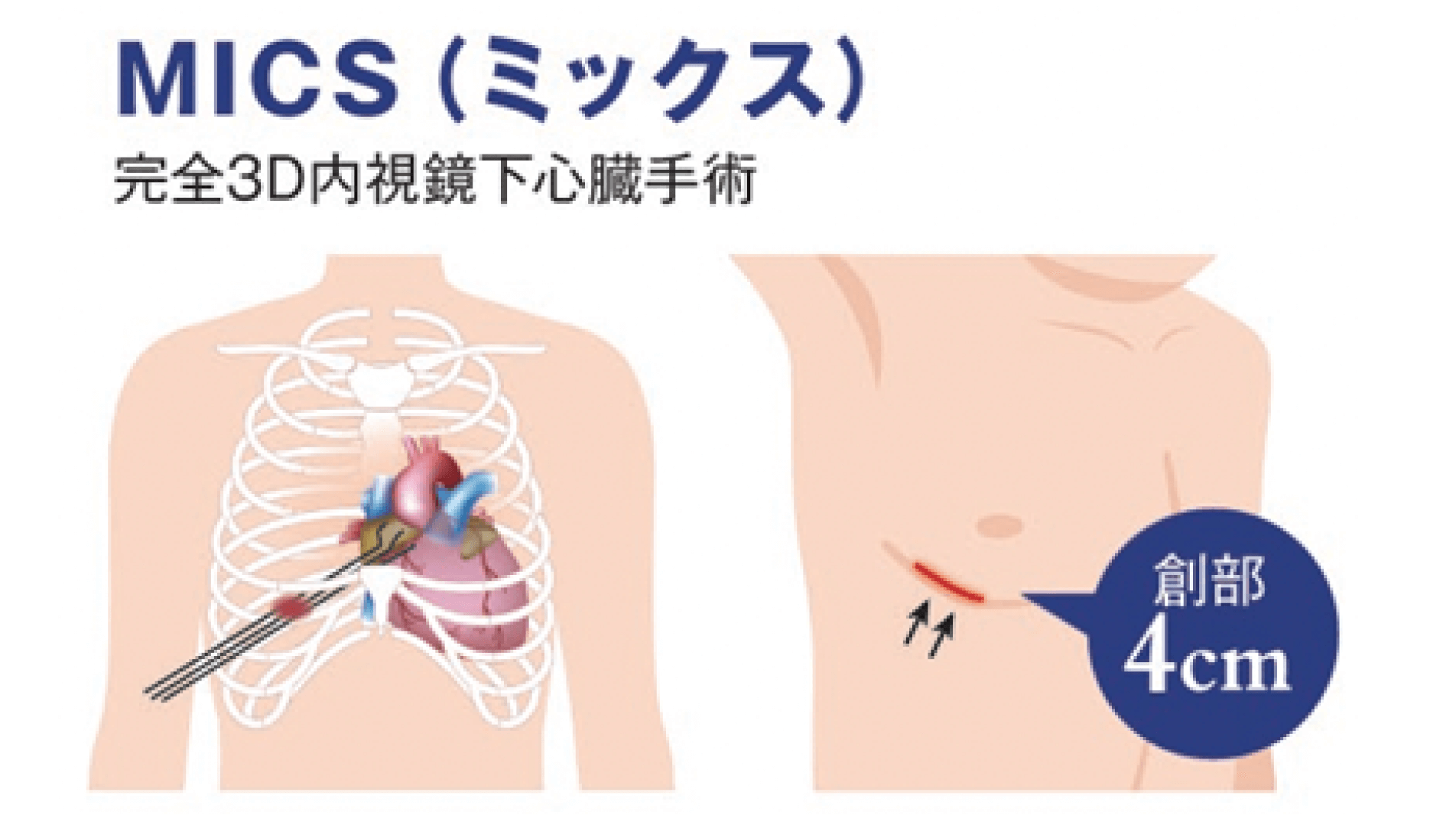 内視鏡下MICSやカテーテル治療などを導入し、高い根治性と負担軽減の両者を追求する