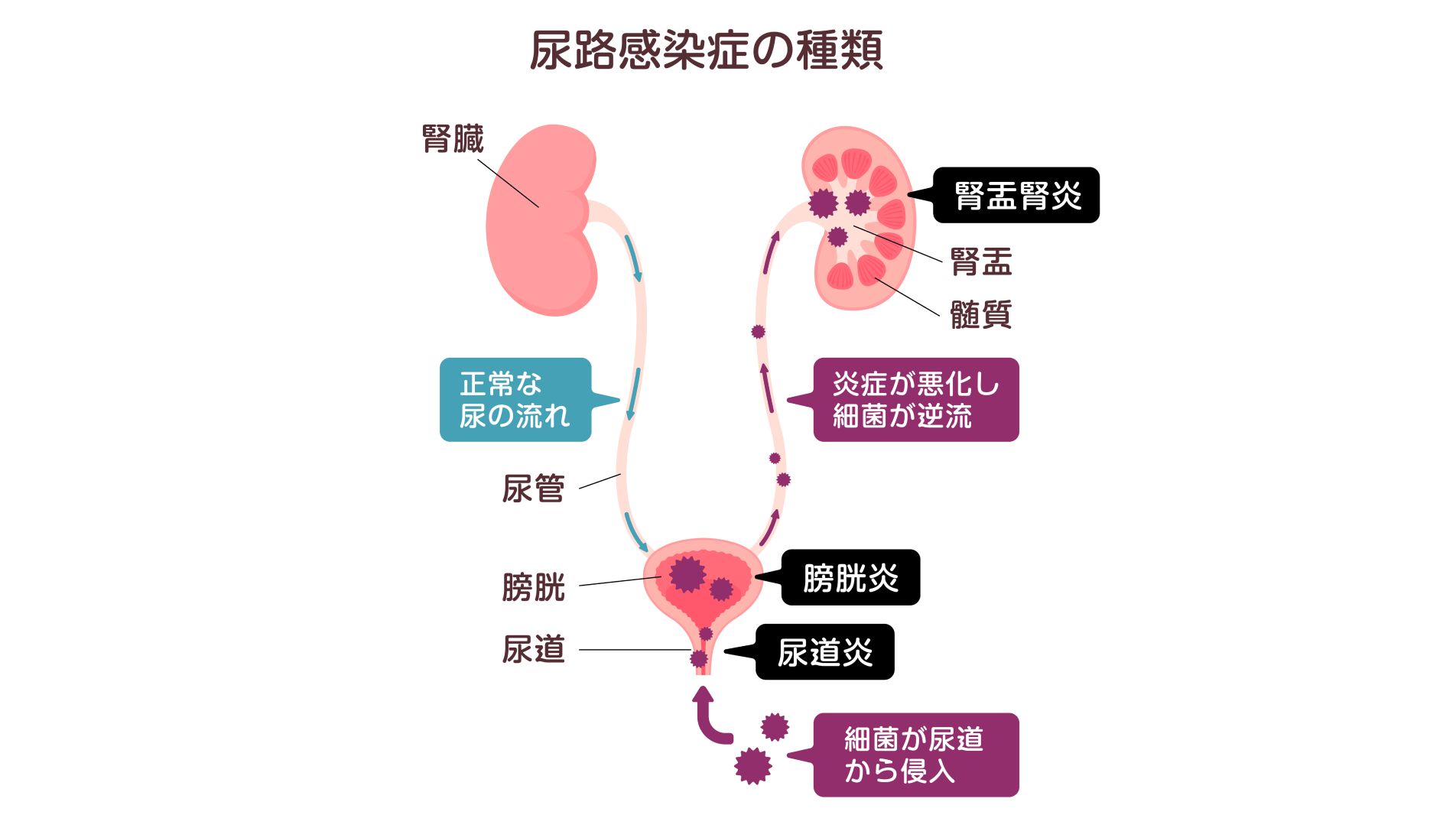 重症化することも――いつもと違うと感じたら軽視せず一度受診を