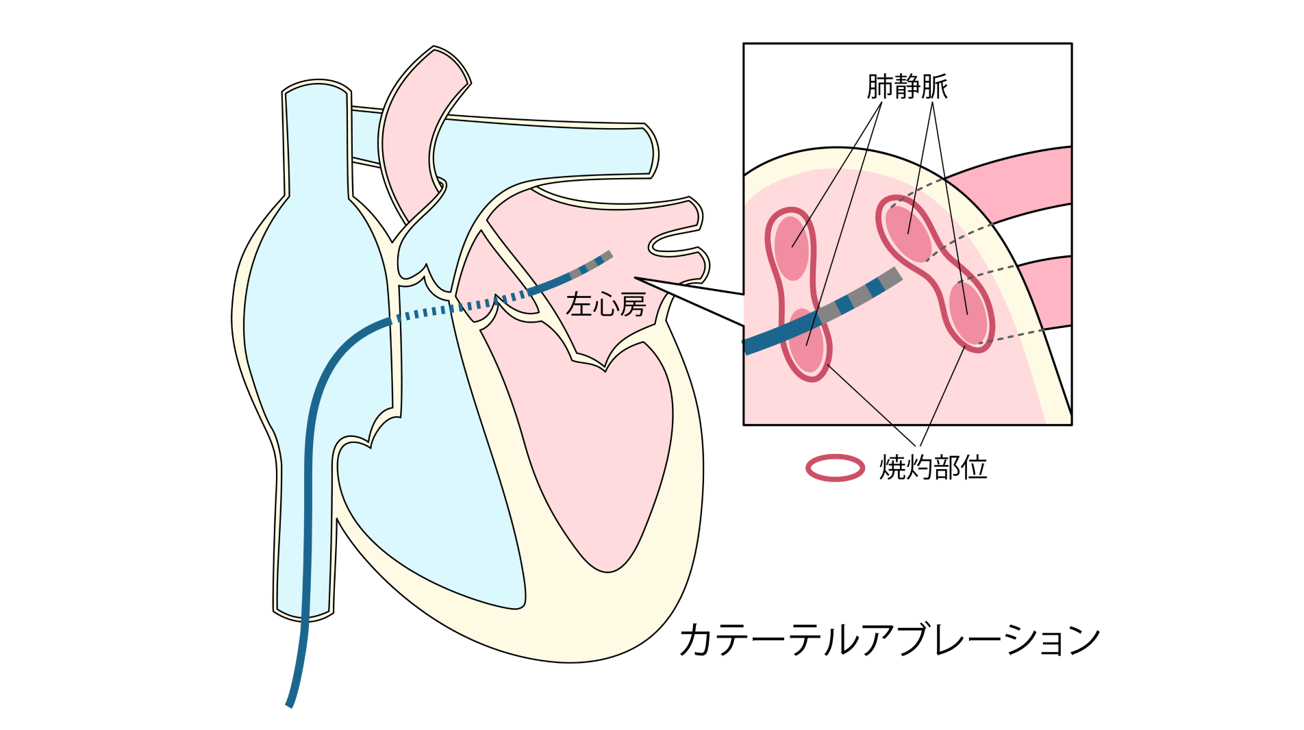 新たな治療法も導入し、的確な診断とより安全な不整脈治療を追求する