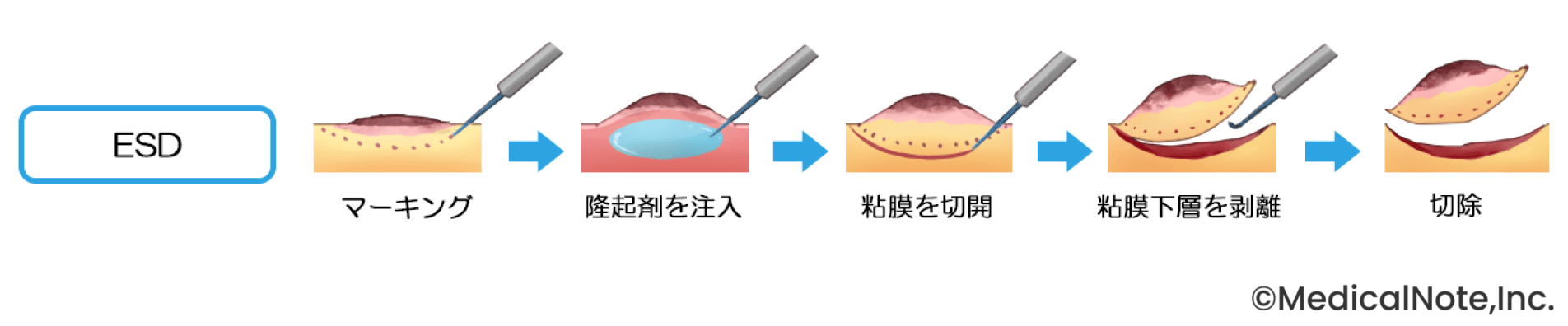 指導医を中心とした盤石なチーム体制で、患者さんの術後の生活を守る