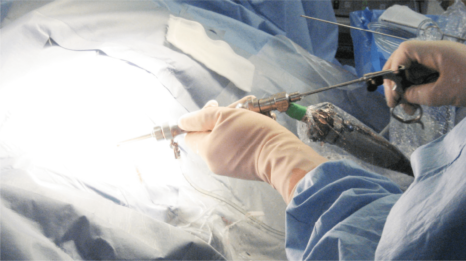 幅広い治療選択肢を備え、より小さな傷で痛みの軽減を目指す