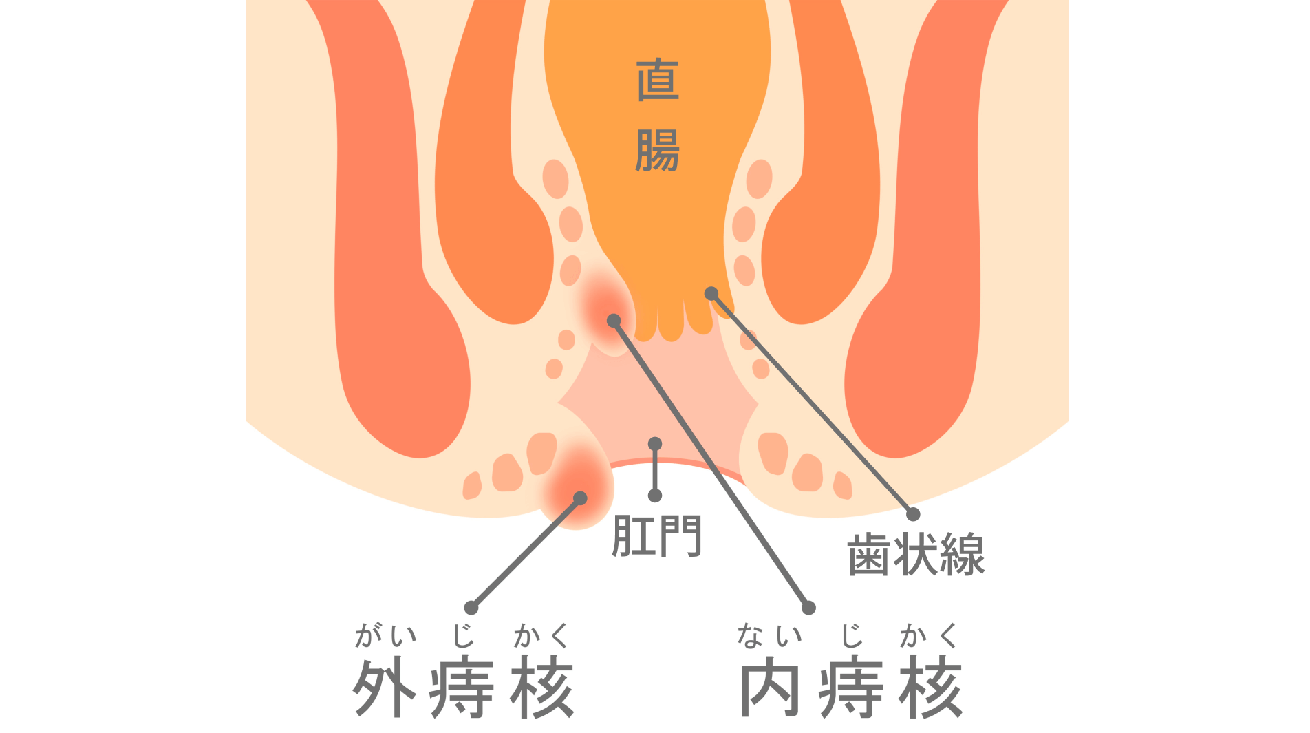 痛みや出血は一度受診を――“切らずに治す”を基本に負担の少ない治療に注力
