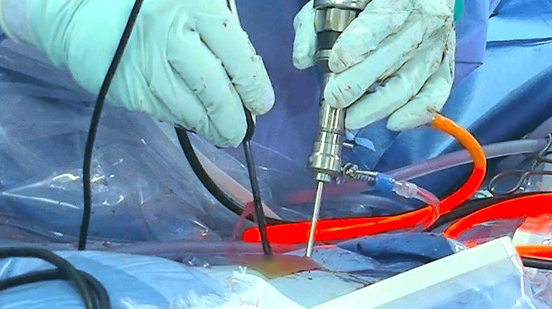 国内普及に貢献してきた知見と経験を生かし、より安全かつ体にやさしい手術を追求