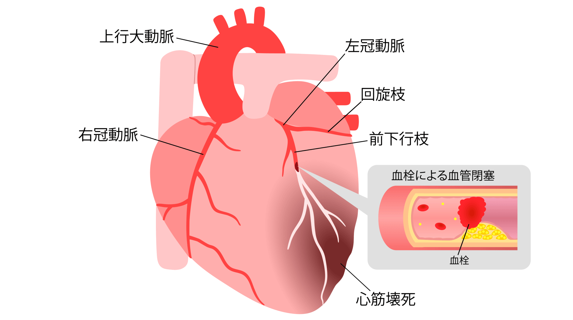 動いた際の胸の違和感は一度受診を