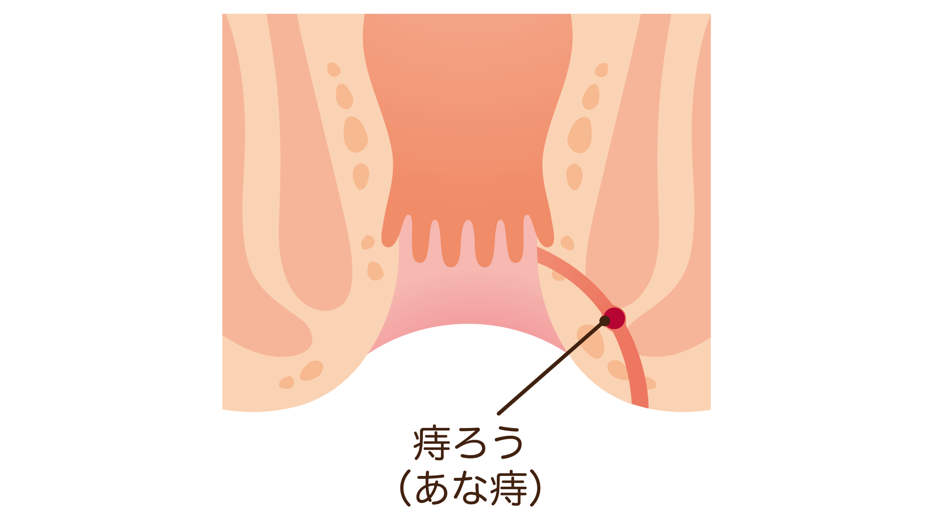 放置はがんの恐れも――自分で見えない場所だからこそ早めに相談してほしい