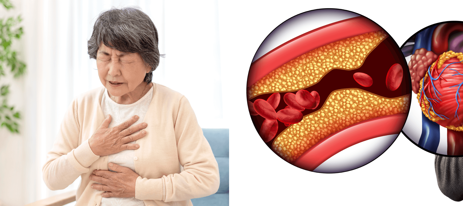 幅広い年代で発症する病気――胸の違和感は一度受診を