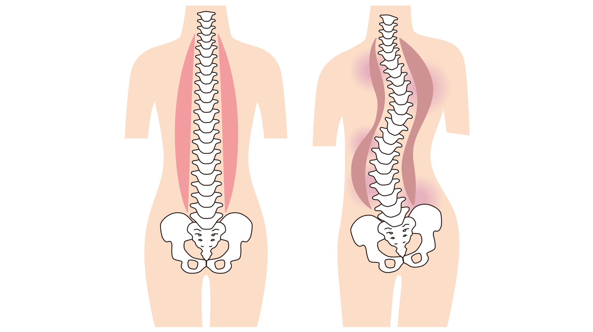 思春期に多い病気――成長段階を見極めた治療選択が大切