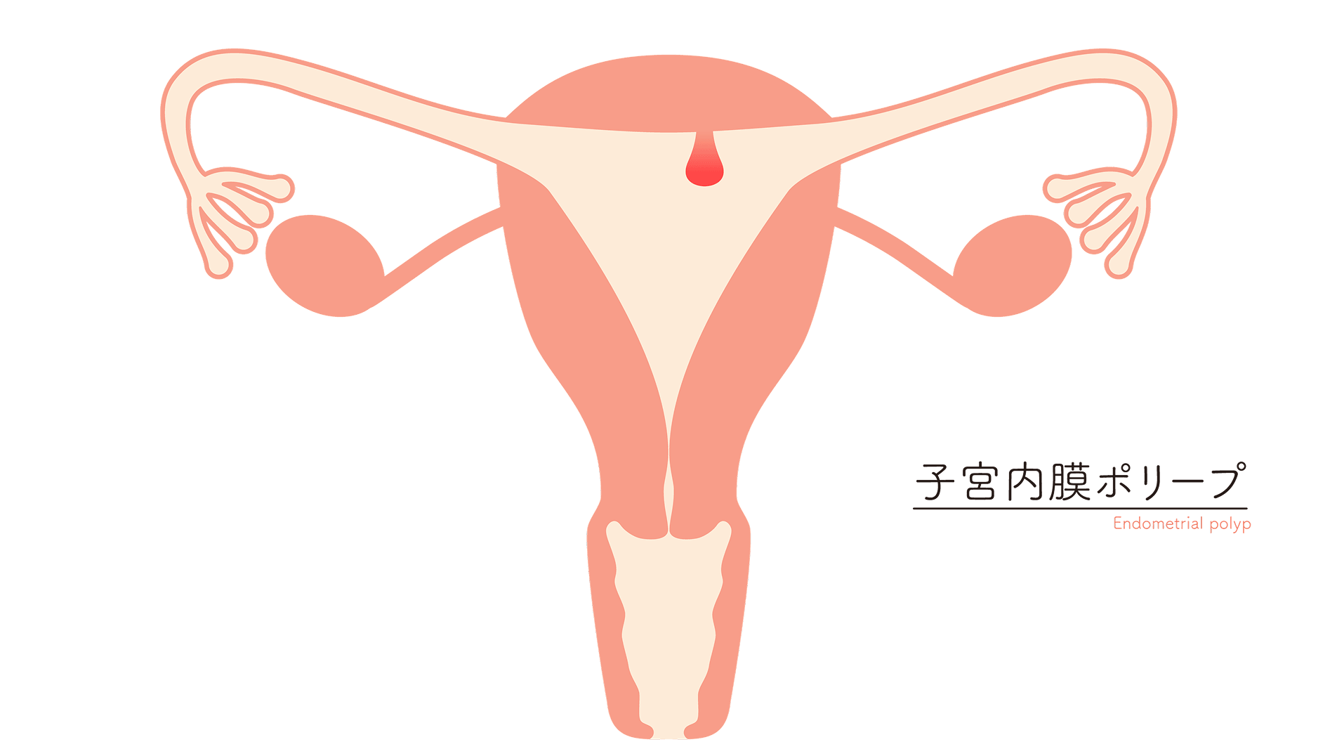 40代以上の女性に多い病気――月経の違和感は放置せず一度相談を