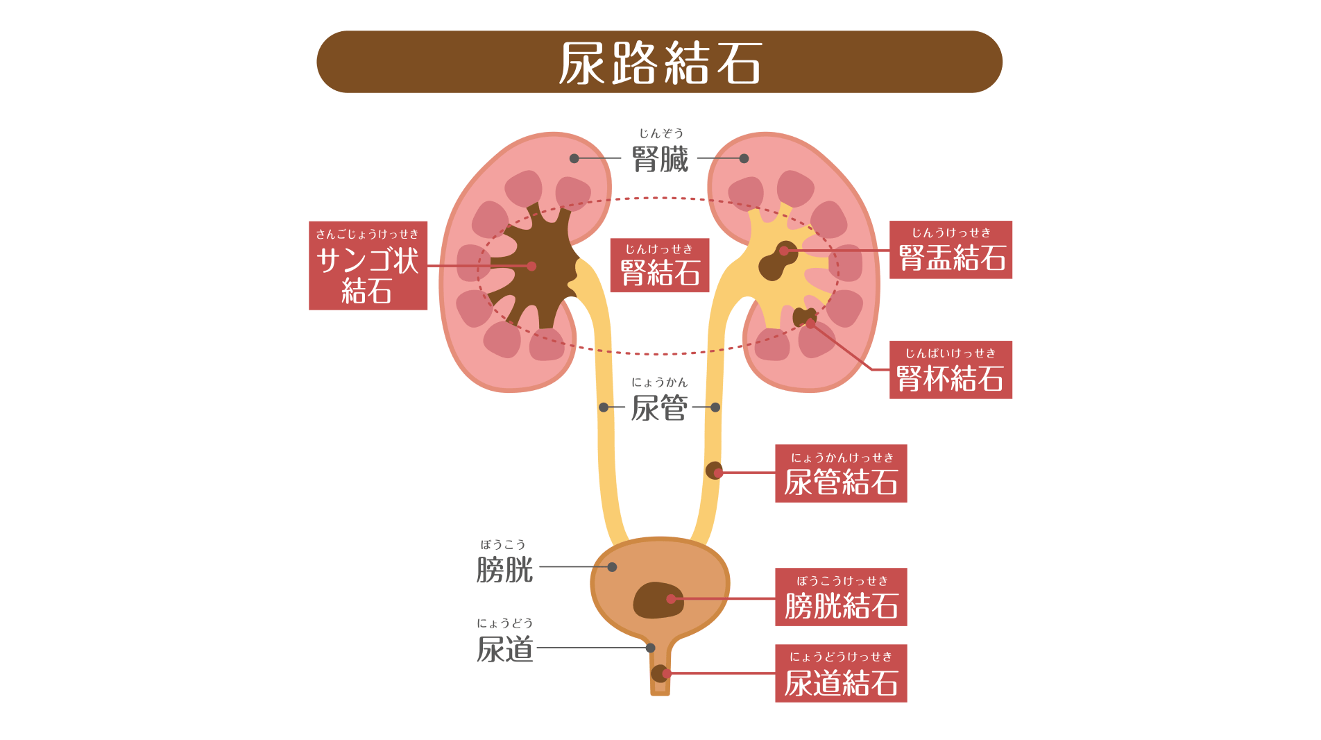 再発しやすい病気――まずは生活習慣の改善を