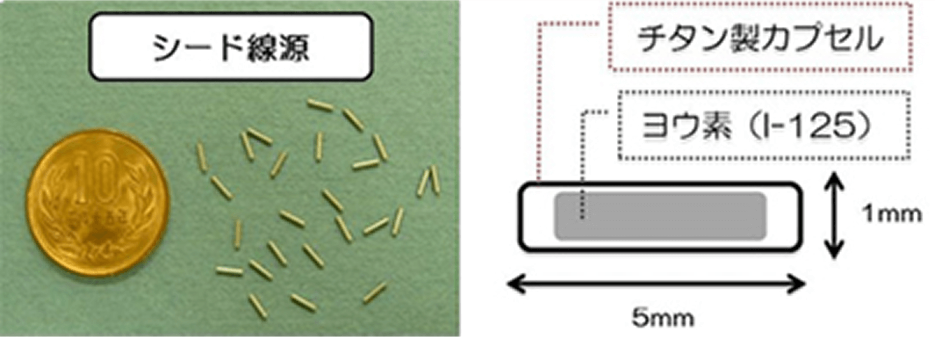 幅広い治療選択肢で患者さんに寄り添った前立腺がん治療を提供