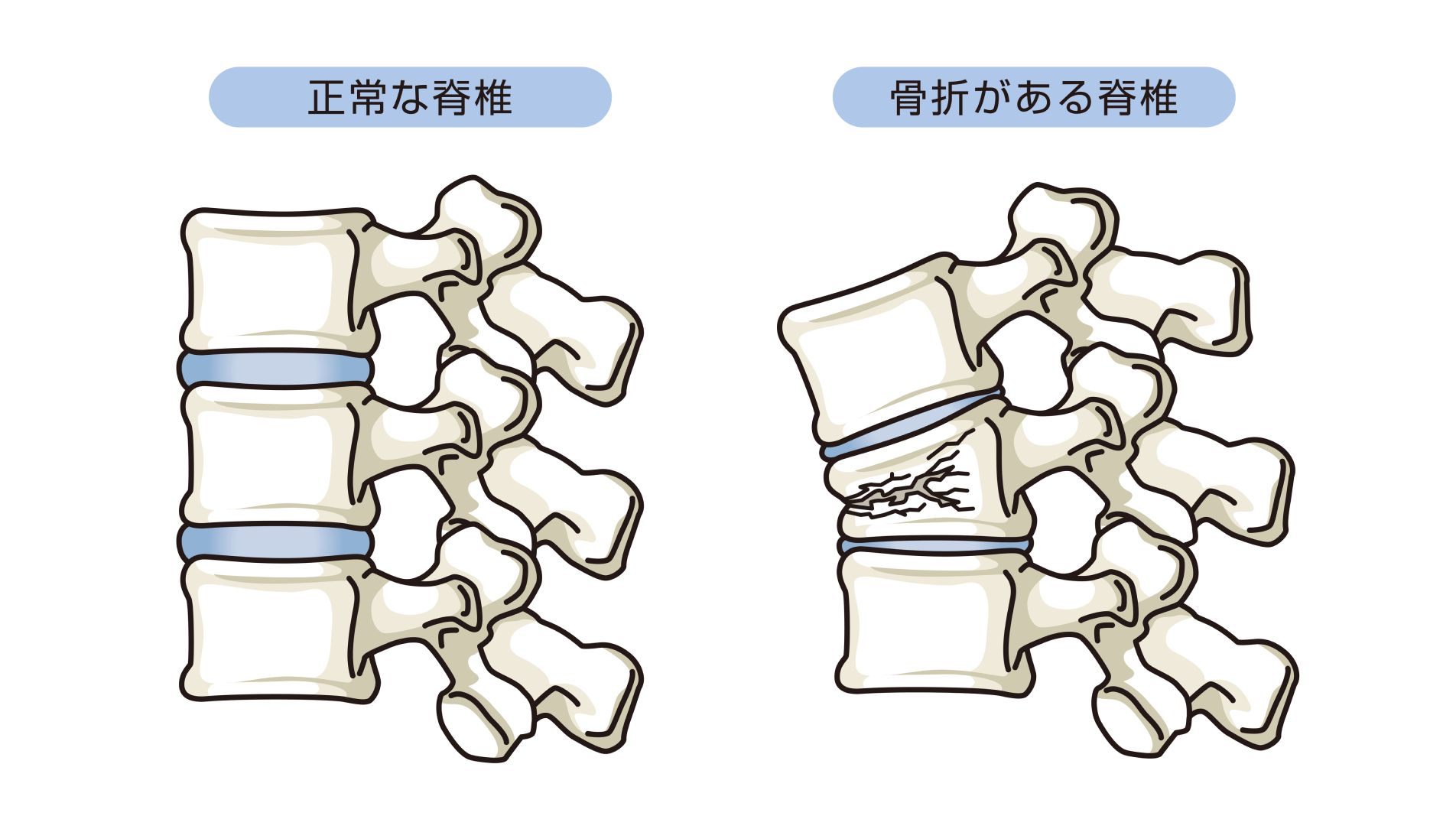 高齢者に多い病気――専門的な観点からより確実性の高い診断に努める