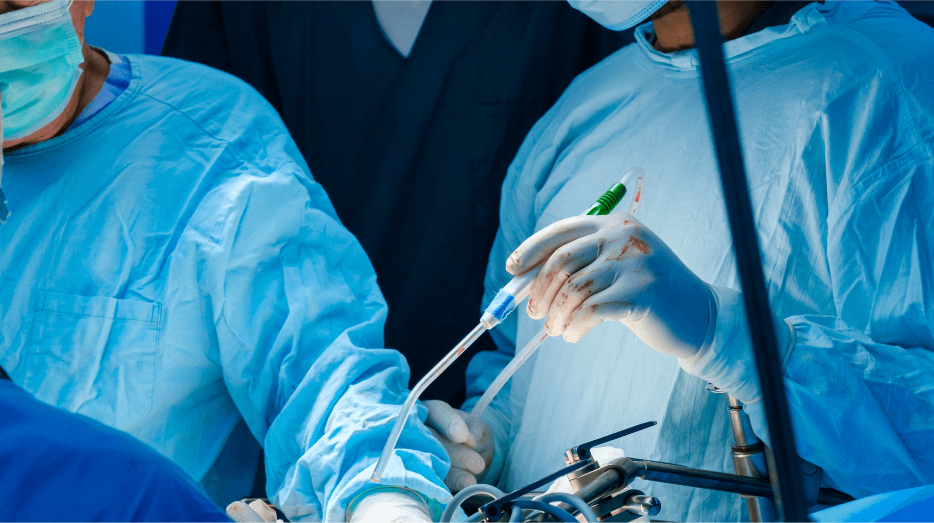 遠隔モニタリングシステムによる管理のほか、デバイスの抜去にも対応