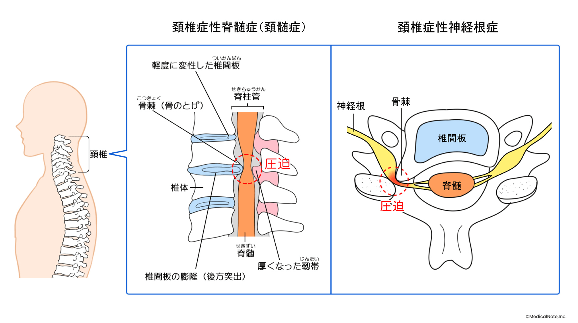 原因の的確な鑑別と、内視鏡を駆使した治療で機能回復を目指す