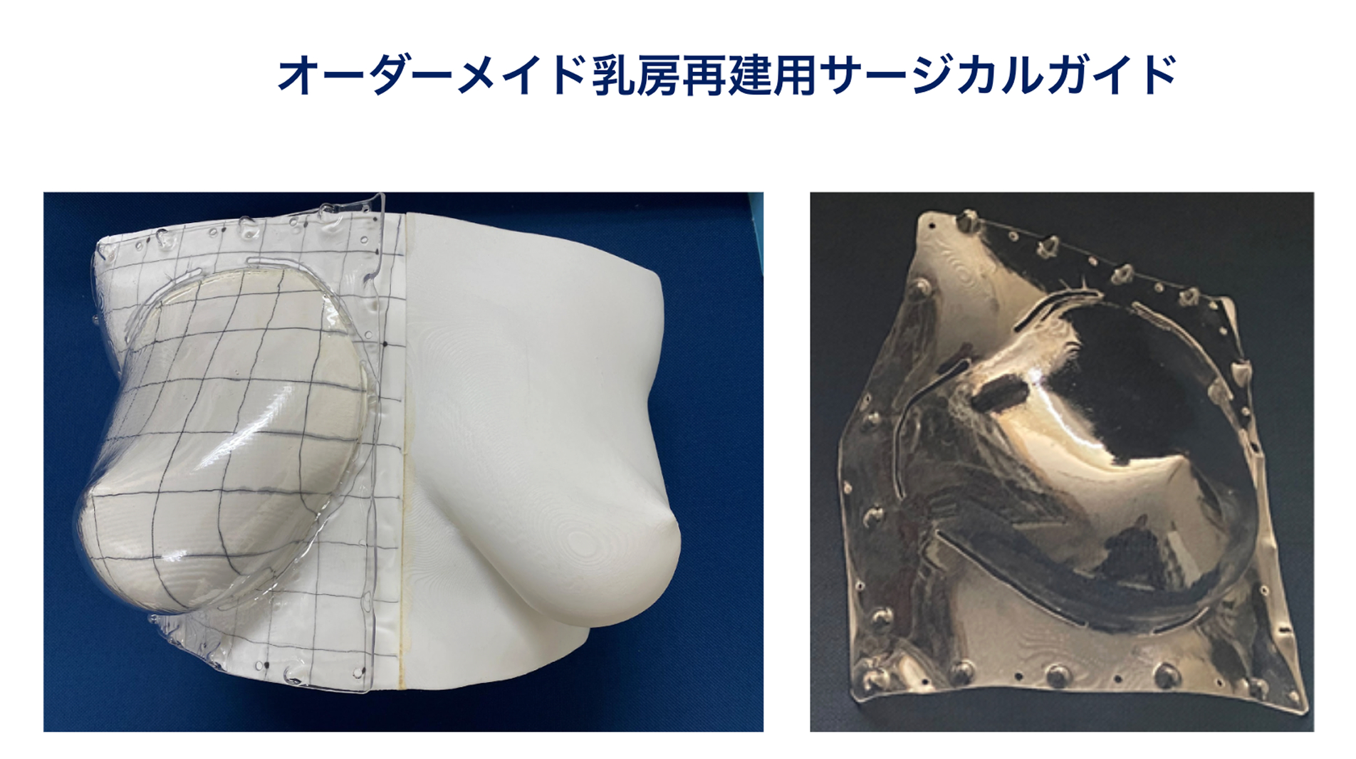 “とことんキレイに美しく治す”をモットーに――患者さんに合った乳房再建を提案