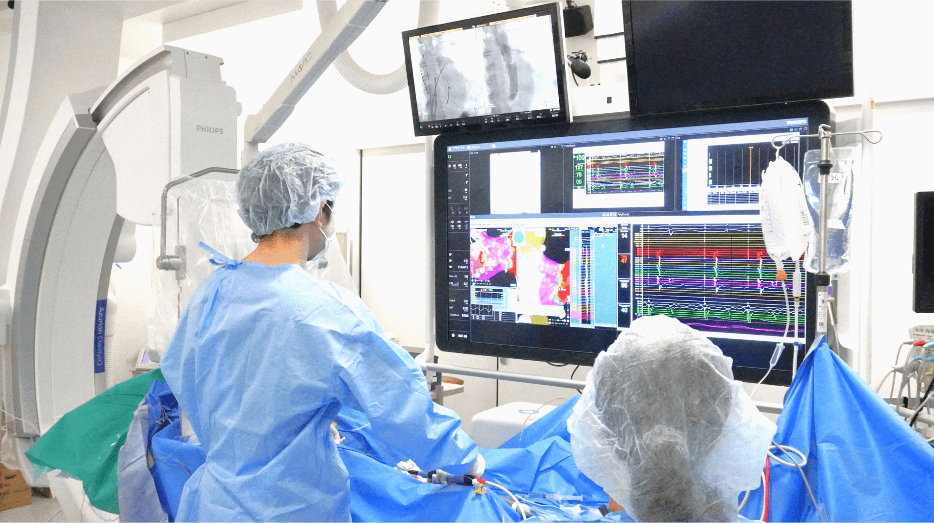 合併症の少ない新たなアブレーションを導入し、よりよい不整脈治療を追求する