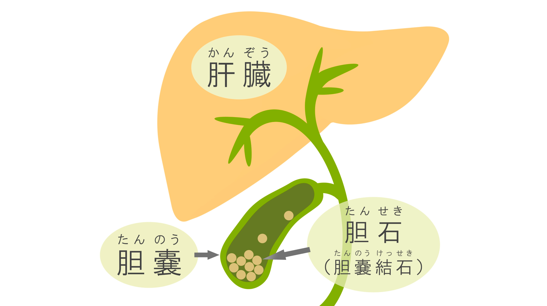 繰り返す食後の腹痛は要注意――不安があればエコー検査の受診を
