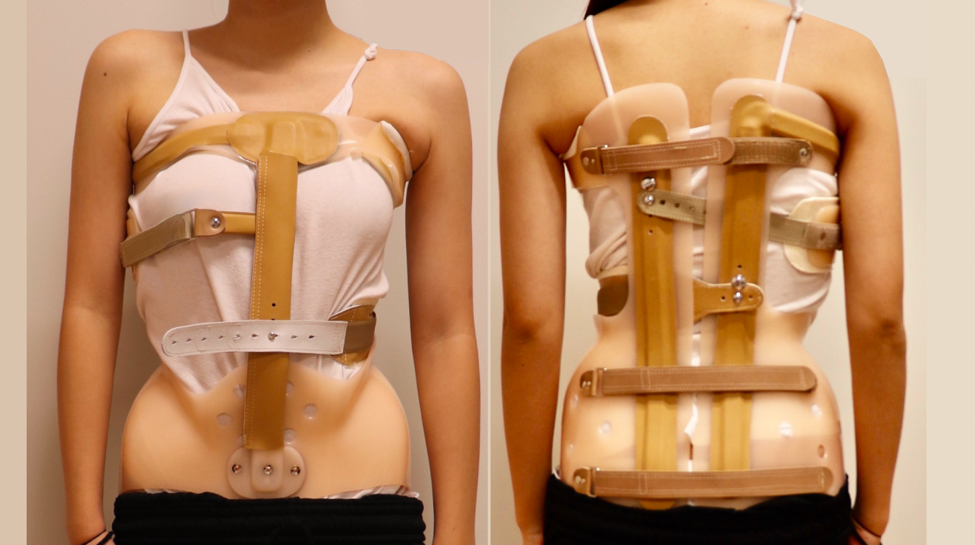 お子さんの意思を尊重し、治療方針を決定