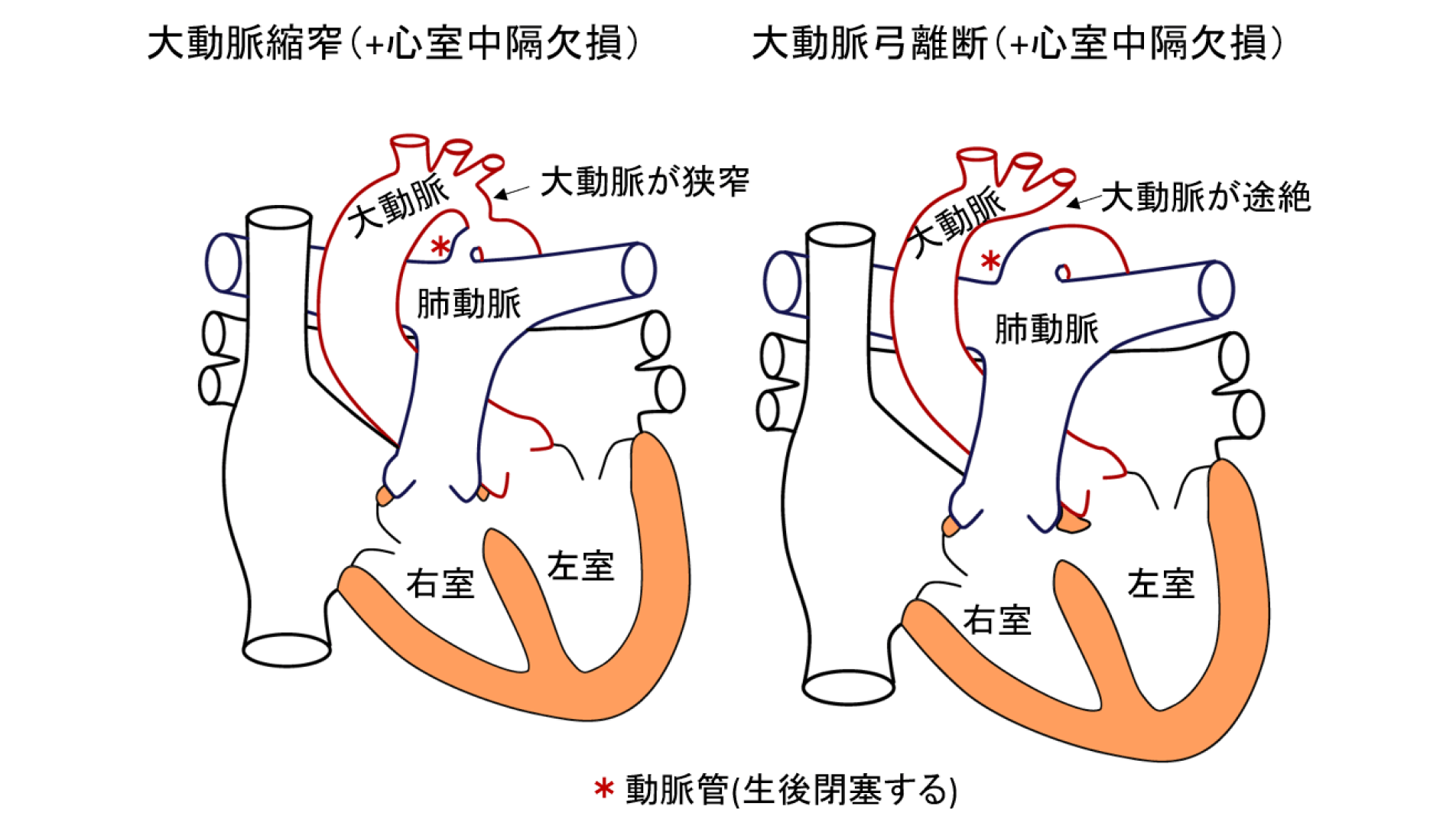 大動脈縮窄症・大動脈弓離断の治療――短時間で病態を見極め、よりよい治療を追求