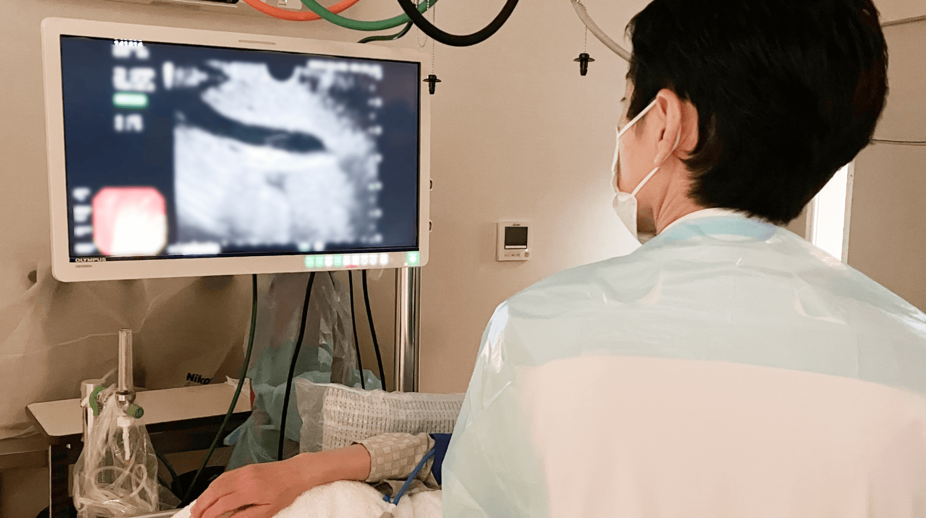 負担の少ない腹腔鏡下手術から内科的な処置の胆嚢ドレナージ術まで対応