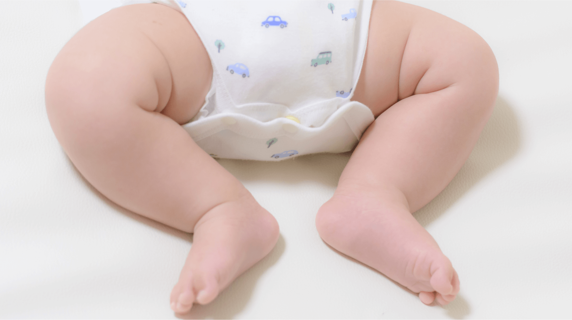 家庭では気付きにくい脱臼――気になる足の左右差は医師へ相談を