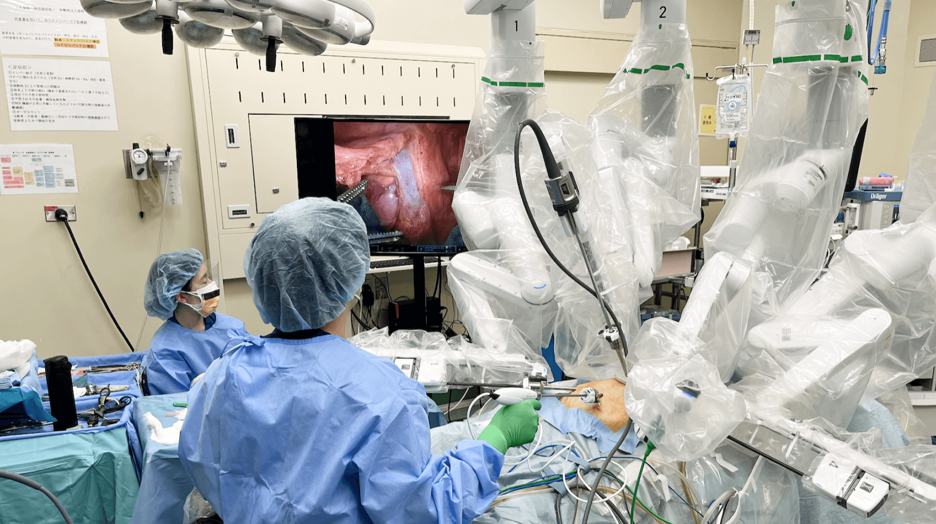 進行大腸がんの治療：ロボット手術により患者さんに“やさしい治療”を実践
