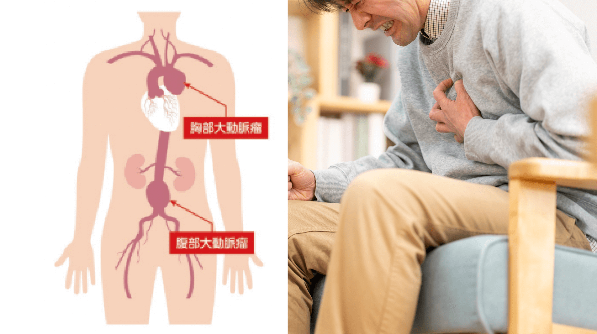 突然発症し命を奪う、“サイレントキラー”